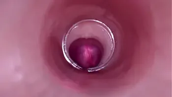 Female Insemination - Internal Camera Captures Deep Male Ejaculation