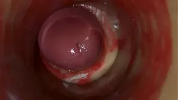 Camera Inside Deep Pussy Captures Huge Ejaculation of Sperm ASMR