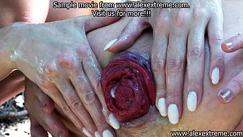 Irina Faust & Hotkinkyjo Extreme Anal Fisting and Prolapse Outdoor Sex in Forest Near Public Trail