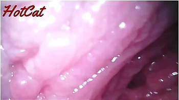 Endoscopic Vaginal Observation